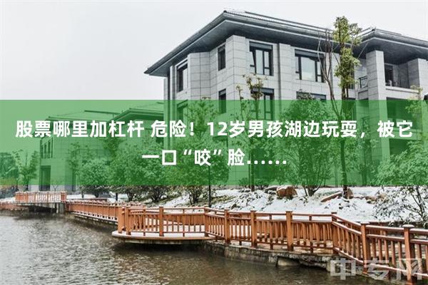 股票哪里加杠杆 危险！12岁男孩湖边玩耍，被它一口“咬”脸……
